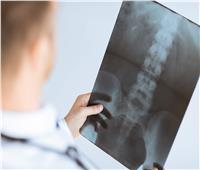 «دراسة»: الهيكل العظمي مسئول عن ألم الظهر والركبتين 