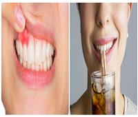 مشروبات تسبب التهاب اللثة وتآكل الأسنان تعرف عليها