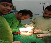 إجراء 3 عمليات جراحية متقدمة بمستشفى الوقف في قنا 