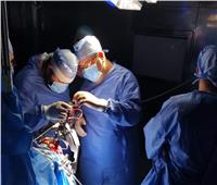 نجاح جراحة نادرة لتركيب جهاز محفز لخلايا المخ لسيدة في مستشفى جامعة طنطا