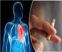 استشاري أمراض قلب يُعدد 6 مخاطر لـ التدخين