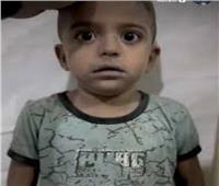 رد يمزق القلوب من «كمال» طفل غزة المرتجف