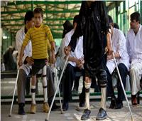الصحة تؤكد خلو مصر من مرض شلل الأطفال