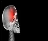 احذر| 6 أعراض قد تشير لإصابتك بورم في المخ