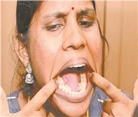 أسنان هندية تُدخلها «جينيس»
