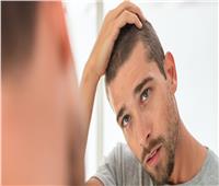 5 أسباب للصلع عند الرجال وكيفية علاجه؟