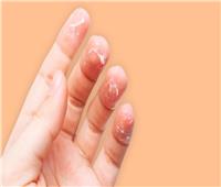 الالتهابات الأبرز.. 5 أسباب أساسية تؤدي إلى تقشير الجلد