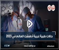 فيديوجراف| حالات طبية غريبة أدهشت العالم في 2023