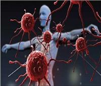 أمراض المناعة الذاتية.. «وباء خطير» أكثر انتشارا بين النساء