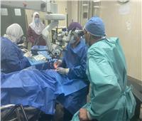 مستشفى سوهاج الجامعي ينقذ عاملا من "عمى" محقق بعد إصابته بشظية فالشبكية