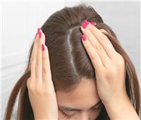 10 وصفات منزلية فعالة لمحاربة قشرة الشعر