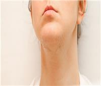 التوتر والتدخين الأبرز.. 6 أسباب وراء ظهور شعر الوجه لدى النساء