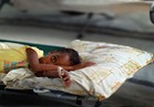 وزارة الصحة اليمنية: تراجع ملحوظ في حالات الإصابة بالكوليرا