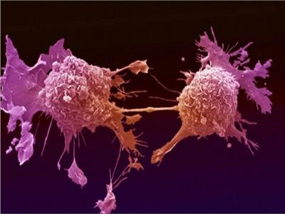 خلية سرطانية 