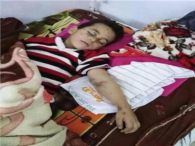وفاة طفل "السرطان" بالمستشفى العام في الاسماعيلية