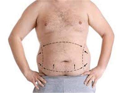  أنواع عمليات شفط الدهون للرجال