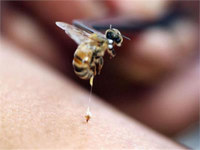 العلاج بـ«لدغات النحل»| متخصصون: صيدلية ربانية