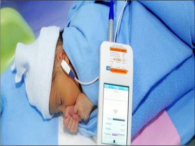 توفير 18 جهاز مسح سمعي لحديثي الولادة بشمال سيناء