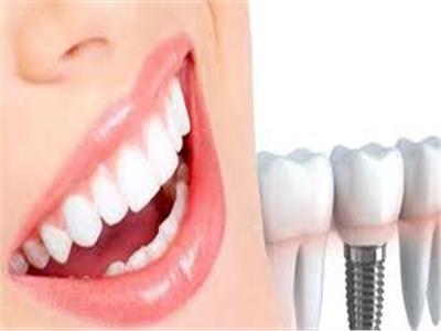  الفروق بين زراعة الأسنان التقليدية وزراعة الأسنان الفورية