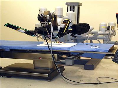 خبير: استخدام تطبيقات جراحات الروبوت الأمثل لعلاج الأورام