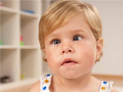 «حول الأطفال» ٣ أعراض تستدعي زيارة طبيب العيون فورا