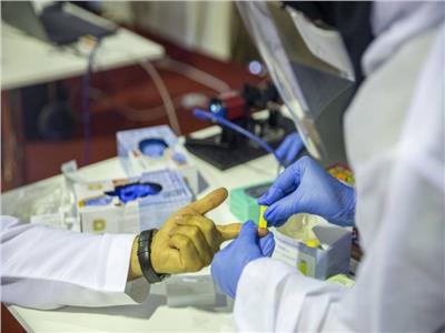وزير الصحة الكويتي: شفاء 587 حالة مصابة بفيروس كورونا