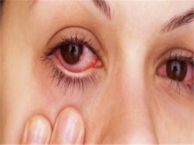 روشتة وقائية للتخلص من أمراض العين في فصل الخريف 