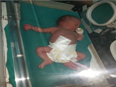 مستشفى المنيرة ينقذ طفل عمره 3 أيام بجراحة عاجلة