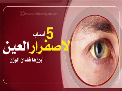 إنفوجراف| 5 أسباب لاصفرار العين.. أبرزها فقدان الوزن