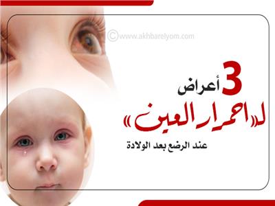 إنفوجراف | 3 أعراض لـ«احمرار العين» عند الرضع بعد الولادة