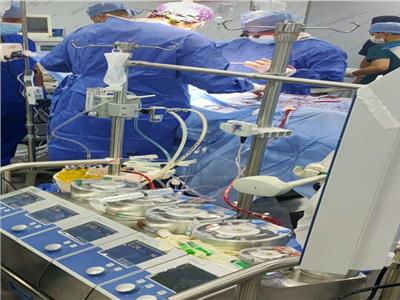  إجراء أول جراحة قلب مفتوح بالشرقية بمستشفى الزقازيق العام