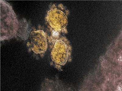 خلية مصابة بفيروس كورونا