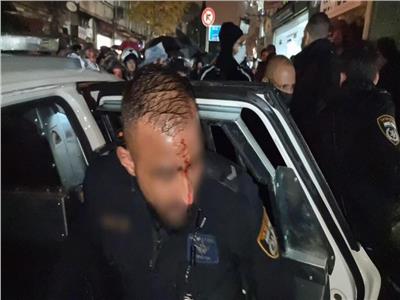 أصابة فرد أمن من الشرطة الاسرائيلية بجروح في الرأس