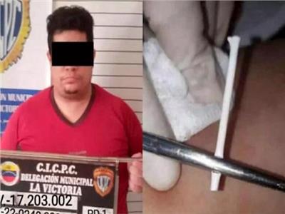 القبض على طبيب مزيف يزرع عصا مصاصة تحت الجلد كموانع حمل