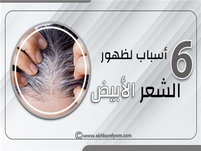 إنفوجراف | 6 اسباب لظهور الشعر الابيض