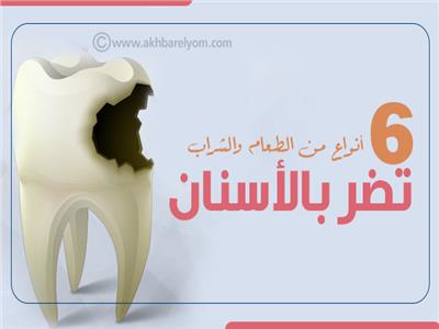 إنفوجراف| 6 أنواع من الطعام والشراب تضر بالأسنان