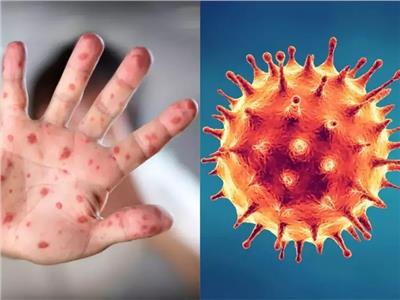  هل نواجه وباءً أكثر خطورة من كورونا ؟