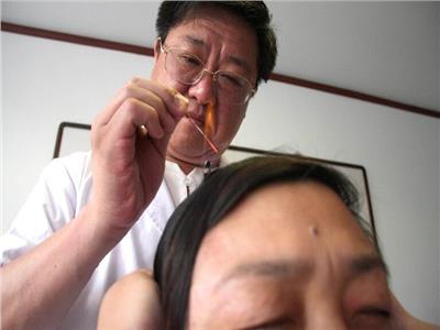 طبيبة مختصة: «الإبر الصينية» لم تثبت فعاليتها علميا