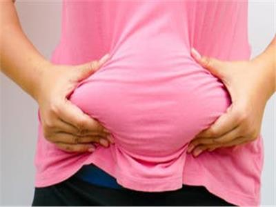  الدهون المتراكمة في منطقة البطن