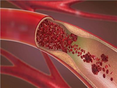 الأوعية الدموية 