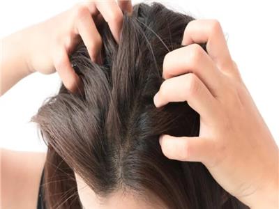 علاجات فعالة لمنع حكة فروة الرأس