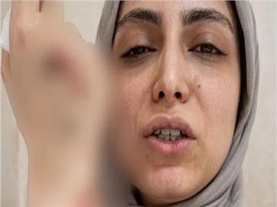 إصابة طبيبة بكسر خطير