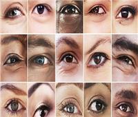دراسة تحدد 50 جينًا جديدًا يلعب دورًا في تلوين قزحية العين