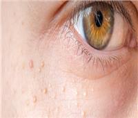 4 علامات تظهر على الجلد مؤشر لأمراض خطيرة