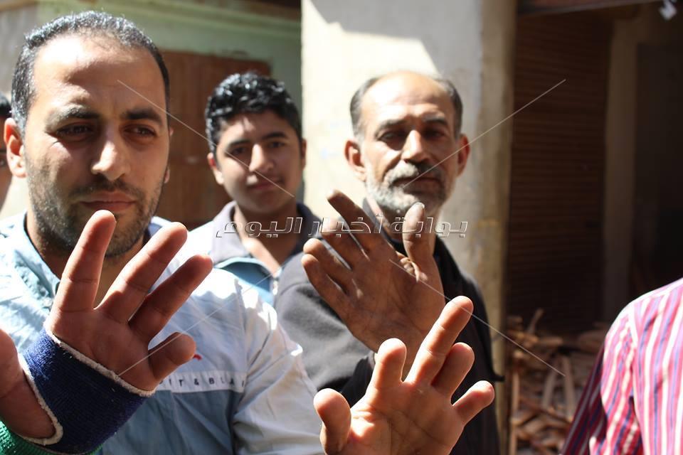  أكل العيش بـ«نصف أصابع»