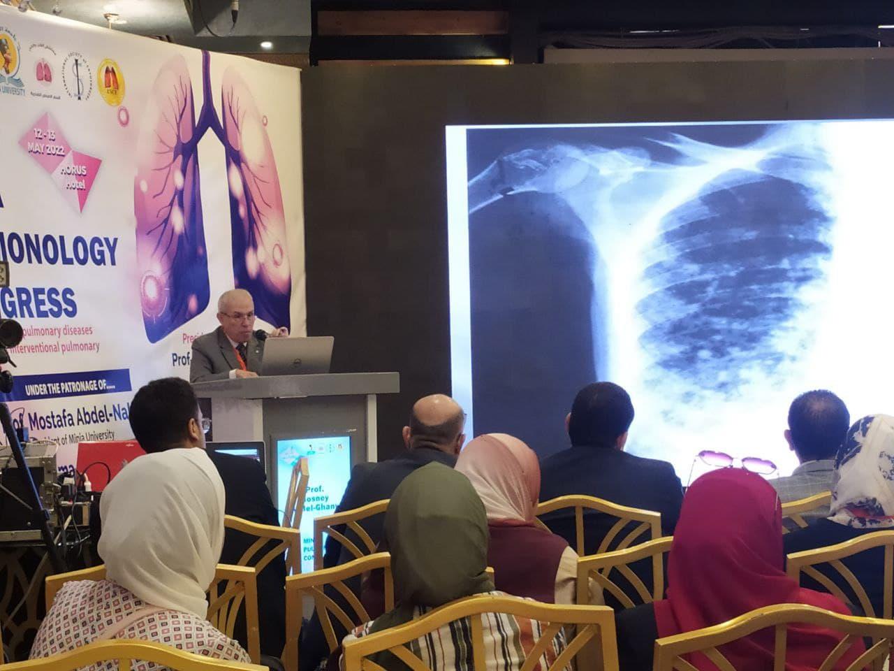 قسم الأمراض الصدرية بـ «طب المنيا» يعقد مؤتمره الخامس لأمراض الرئة