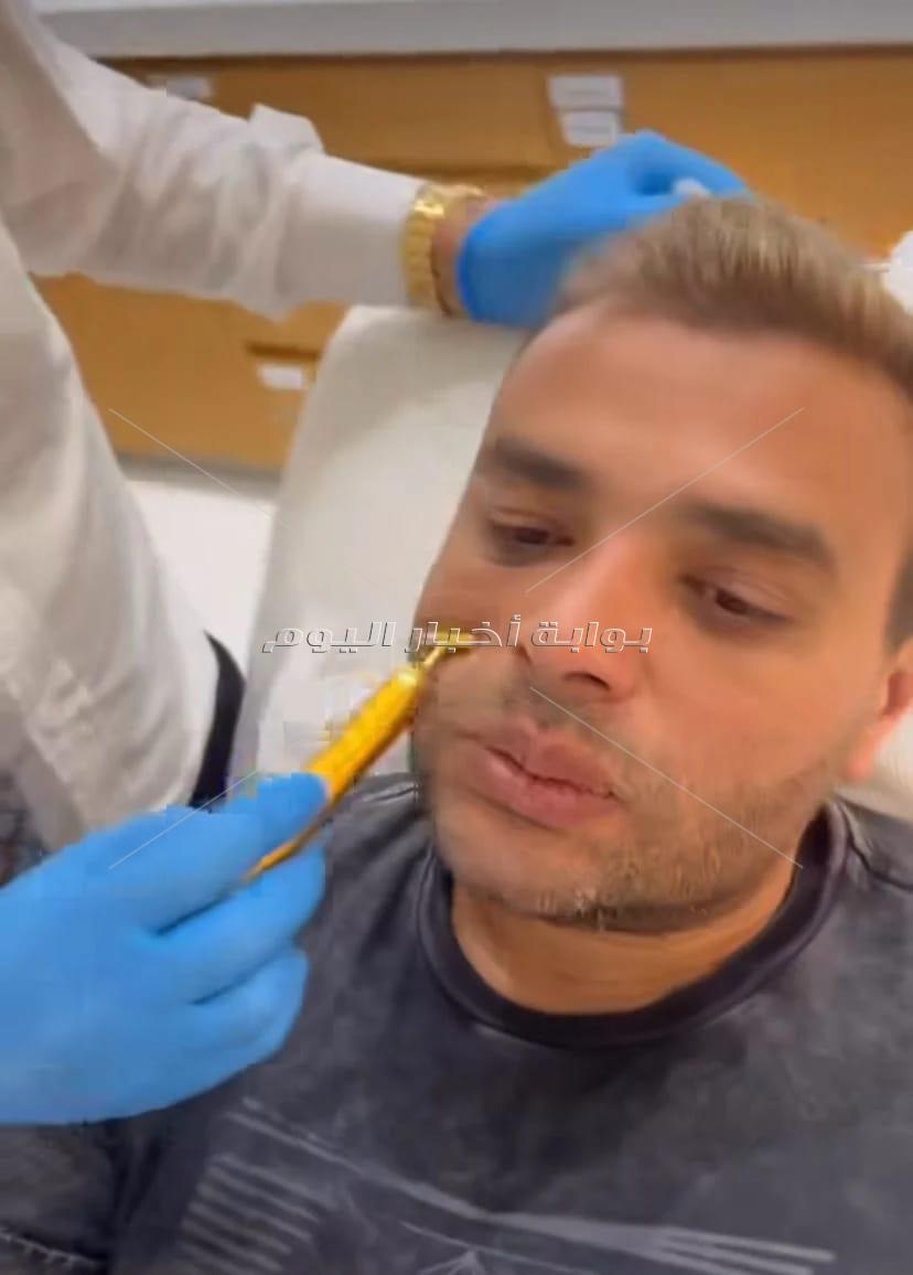 جراحة تجميلية لـ رامي صبري في الوجه