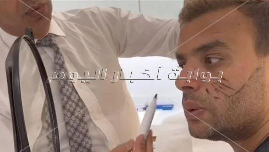 جراحة تجميلية لـ رامي صبري في الوجه