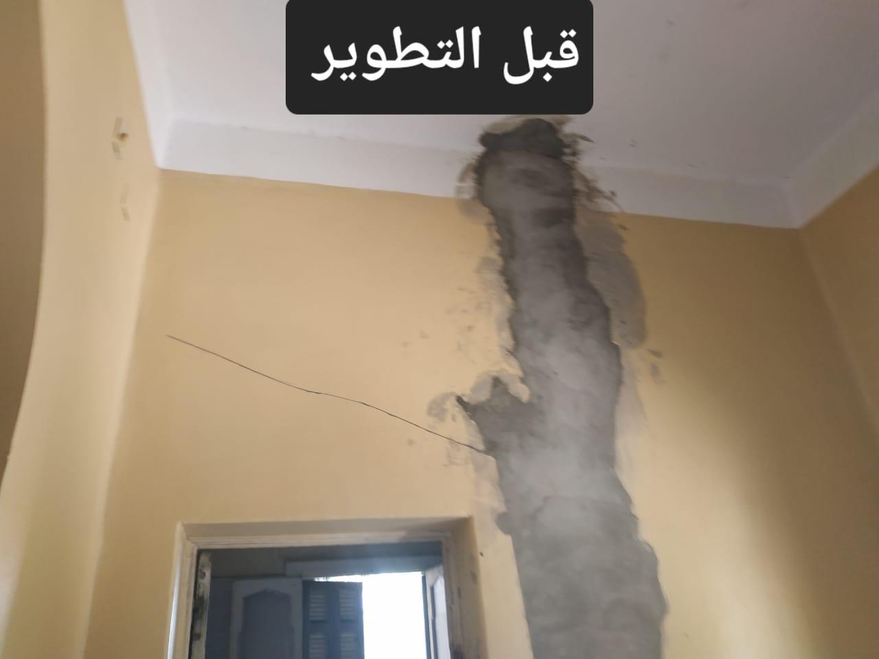 مستشفى الصدر  بالزقازيق بين الماضي والحاضر
