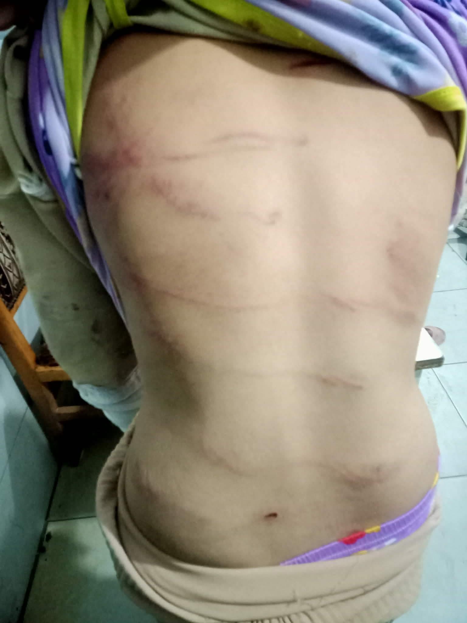 حبس أب عذب طفلته لطلبها شراء أدوات مدرسية بكفر الشيخ| صور
